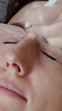 Ameliyat mı? Güzellik iğnesi. Yaşlanma önleyici iğneler. Botulinum terapisi. Yüz tazeleme. Doktor, hastanın alnına güzellik iğneleri için işaretler yapıyor. Kolajen enjeksiyonları.