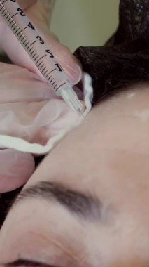 Doktor hastanın alnına güzellik iğneleri yapıyor. Kolajen enjeksiyonları. Yaşlanma önleyici iğneler. Botulin terapisi. Yüz tazeleme.