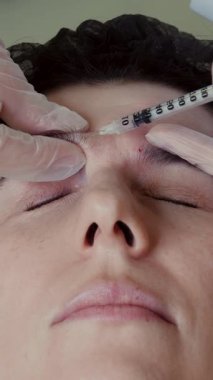 Doktor hastanın alnına güzellik iğneleri yapıyor. Kolajen enjeksiyonları. Yaşlanma önleyici iğneler. Botulin terapisi. Yüz tazeleme.