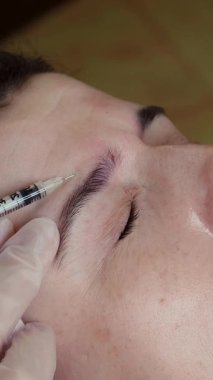 Doktor hastanın alnına güzellik iğneleri yapıyor. Kolajen enjeksiyonları. Yaşlanma önleyici iğneler. Botulin terapisi. Yüz tazeleme.