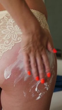 Güneş yanığı. Güneş kremi. Güvenli bronzlaşma. Yakın plan. Kadın eli vücut derisine güneş yanığı ilacı uyguluyor. Kadın güneş yanığı tedavisi için kalın beyaz bir köpük yayar.