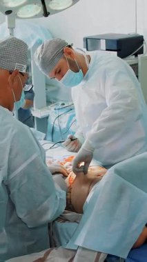 Cerrah, yoğun bir yağ tabakasıyla karın bölgesinin bir kısmını hastadan ayırıyor. Ameliyat, abdominal liposuction ameliyathanede, hastanede.