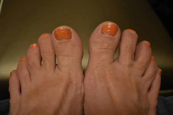 Female Feet Toes Peeling Orange Nail Polish High Quality Photo — Stock Photo, Image