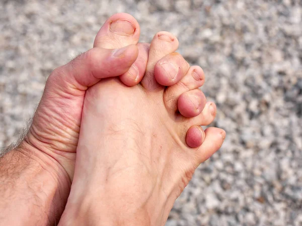 Самомассаж Стопы Раздвинутыми Пальцами Ног Лечения Профилактики Болей Спине — стоковое фото