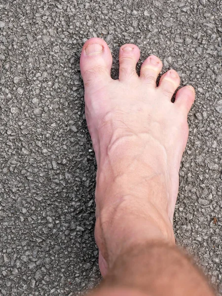 Pie Hombre Con Dedos Extendidos Macadam Para Concepto Caminar Descalzo —  Fotos de Stock
