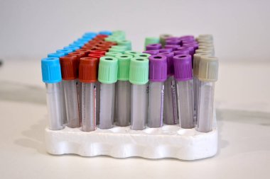 Wallers, Fransa - 03 14 2024: Temiz bir arkaplanda kan örnekleme ekipmanı. Tüp, pompa bedeni, yapıştırıcılar, iğneler, turnike,...