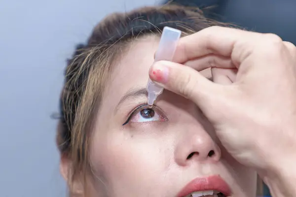 Stock image Male doctor ophthalmologists dripping eye drops on eyes of a female patient during a treatment at the ophthalmological office