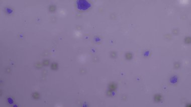 Bokeh ile soyut arkaplan