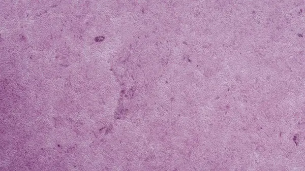 Purpurowe Skóry Tekstury Tła — Zdjęcie stockowe
