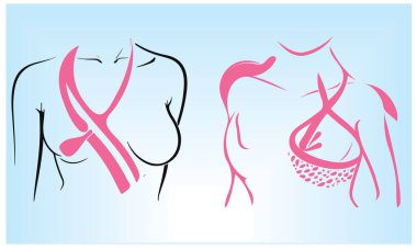 Breast Cancer Importance of Early Detection  clipart