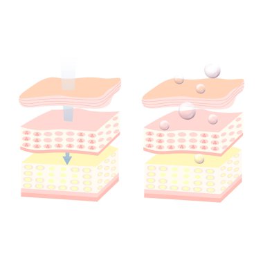 Farklı cilt bakım ürünleri seti, vektör illüstrasyonu