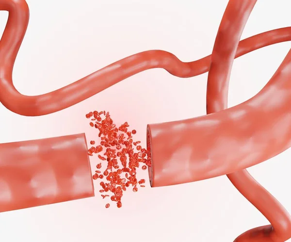 白い背景の3Dレンダリングに白い背景の3Dレンダリングに散在する血管と赤血球の破裂 — ストック写真