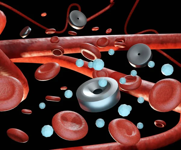 Sistemas Administración Fármacos Implantables Los Vasos Sanguíneos — Foto de Stock