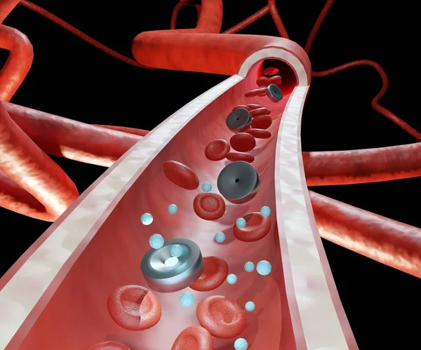 血管内の移植性の高い薬物送達システム3Dレンダリング — ストック写真