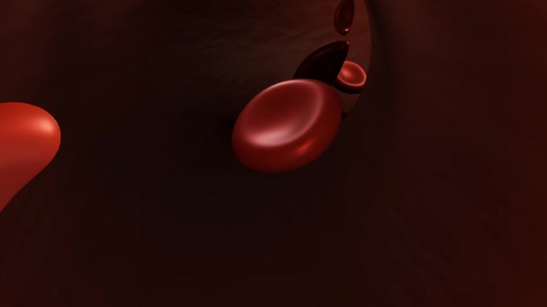 Niedokrwistość Sierpowatokrwinkowa Przepływająca Wewnątrz Naczyń Krwionośnych Niektóre Czerwone Krwinki Wyglądają — Wideo stockowe