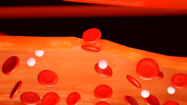 Анімація Гемофілії Призводить Спонтанної Кровотечі Також Кровотечі Після Травм Або — стокове відео