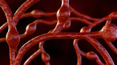 Mikro anevrizmaların (MA 'lar) 3D rendelenmesi, bunlar retinadaki kan damarlarının küçük şişmeleridir.