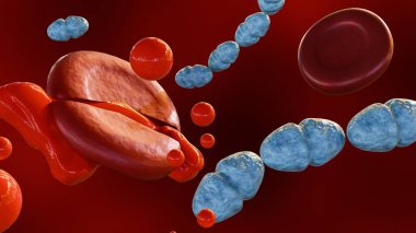 Septiseminin 3 boyutlu olarak yorumlanması, Streptococcus pyogenes bakterisi tarafından kan zehirlenmesinin klinik adıdır..