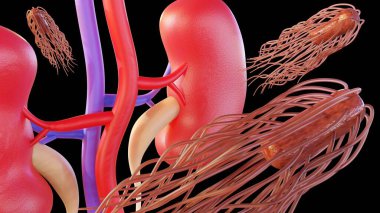 Proteus mirabilis bakterisi böbreklere ulaşır, buna 