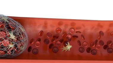 Aktif trombosit ve fibrin içeren bir kan damarındaki trombus oluşumunun 3 boyutlu görüntüsü pıhtı gelişiminde kullanılan birincil hücresel ve protein bileşenleri.