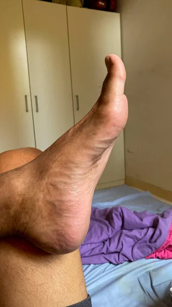 Adam yatakta dinleniyor.