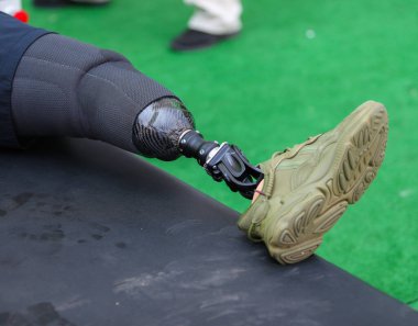 Bacağı yerine yürüyen protezi olan bir adam.