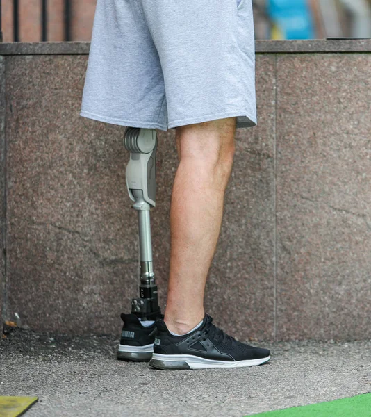 stock image A man with a walking prosthesis instead of a leg