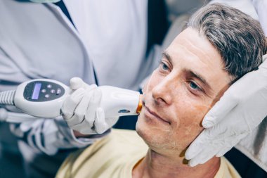 Cilt doktoru, yaşlanma önleyici klinikte kırışıklıkları ve yaraları iyileştirmek için yetişkin erkeklerde lazer yüz bakımı teknolojisi kullanıyor.