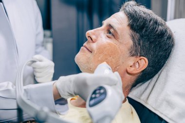 RF Thermage kullanan cilt doktoru. Yaşlanma karşıtı klinikte kırışıklıkları ve yaraları iyileştirmek için yetişkin bir erkekle yüz bakımı teknolojisi.