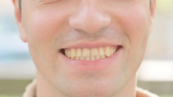 微笑的男性唇及牙齿的近视 — 图库照片