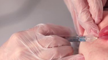 Modern bir dudak enjeksiyonu prosedürüne yakın çekim. Yetenekli bir profesyonel, hassas dudaklar geliştirir, gelişmiş teknikler gösterir. Tıbbi, güzel ve estetik. Yüksek kalite 4k görüntü