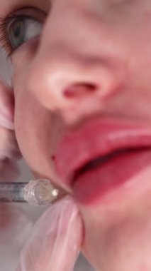  Kozmetik uzmanı, kozmetik güzellik ameliyatı sırasında hastaların dudaklarına iğne enjekte eder. Yüksek kalite 4k görüntü