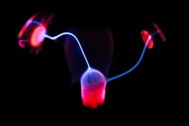 Çarpıcı bir plazma küresi, çekirdeğinden parlak mavi ve pembe elektrik yayları yayarak, karanlıkta büyüleyici ve renkli bir statik enerji gösterisi yaratır..