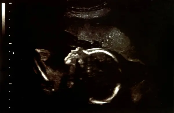 Ultraschall Schwangerschaftsuntersuchung Aus Nächster Nähe — Stockfoto