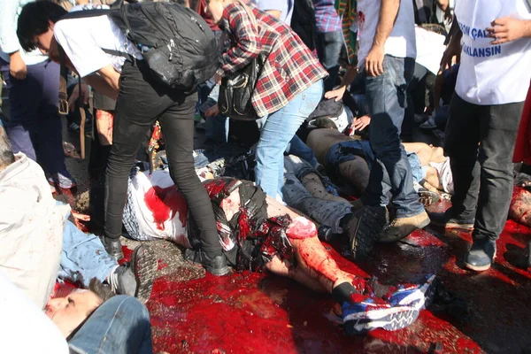 TÜRKİH, Ankara: 10 Ekim 2015 'te Ankara' da en az 30 kişinin hayatını kaybettiği terör saldırısının yaralılarına yardım. 