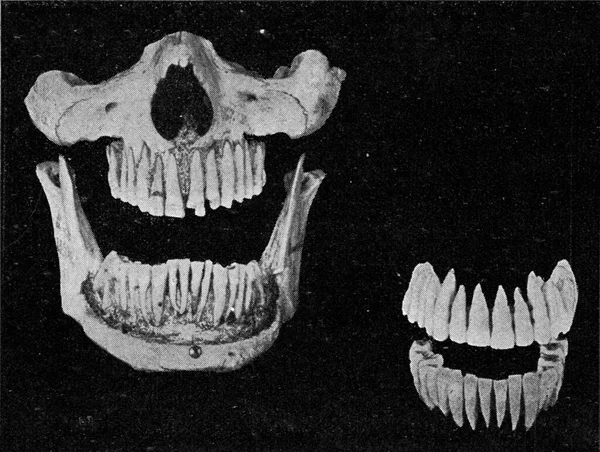 Mänskliga Tänder Käken Och Två Rader Isolerade Tänder Vintage Gravyr — Stockfoto