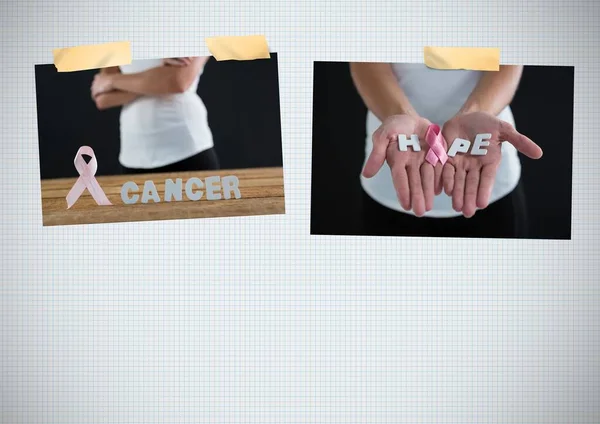 乳がん意識 希望の手紙を握っている女性との写真コラージュ — ストック写真