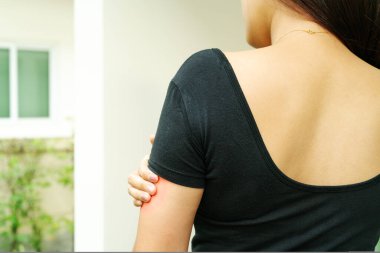 Kadın eli, kolundaki kaşıntıyı, sağlık ve tıp konseptini kaşıyor.