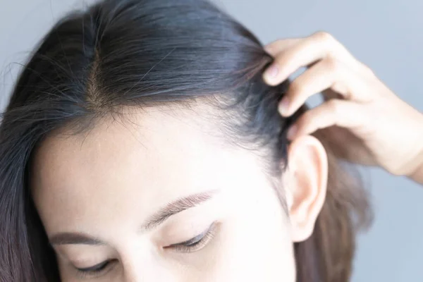 Młoda Kobieta Poważnym Problemem Wypadania Włosów — Zdjęcie stockowe