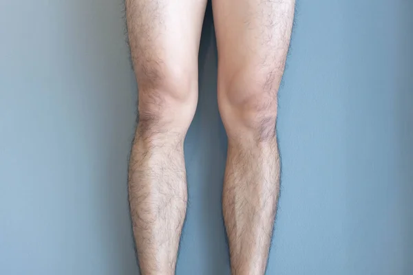 Closeup Legs Men Skin Hairy Health Care Concept — Stock Photo, Image