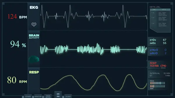 Animation of a fast electrocardiogram reading display
