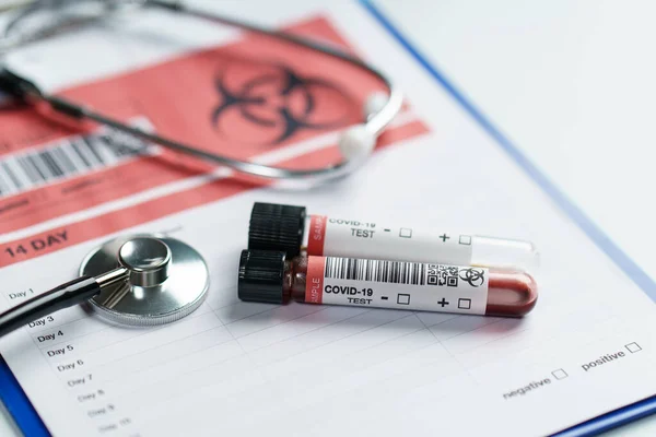Laboratuvarda Kan Testi Tüpü Örnek Toplama Kiti Var — Stok fotoğraf