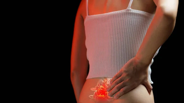 Rückenschmerzen Frau Hält Ihren Rücken Vor Schmerzen Medizinisches Konzept — Stockfoto