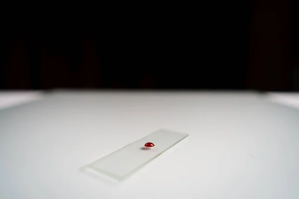 Human Blood Slide Glass Microscope Laboratory — Stock Photo, Image