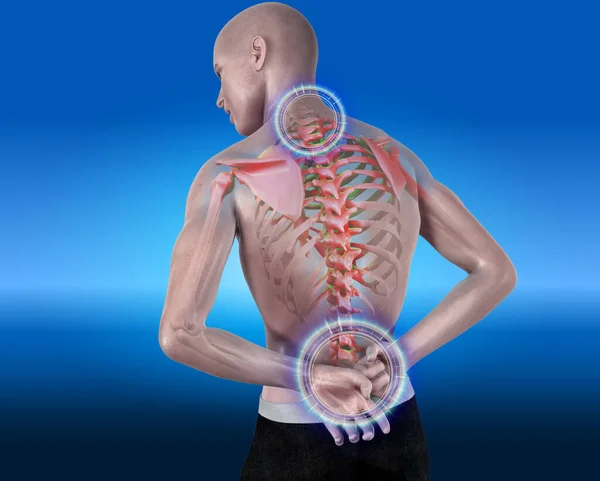 Back Pain Anatomical Vision — Stock Photo, Image
