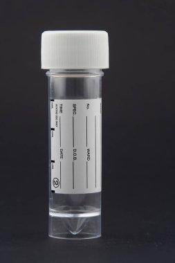 Siyah üzerine temiz plastik numune kabı