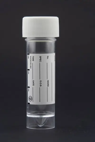 Recipiente Amostra Plástico Transparente Preto — Fotografia de Stock