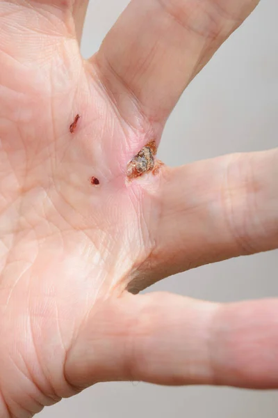 Traces Dog Bite Fingers — Foto Stock