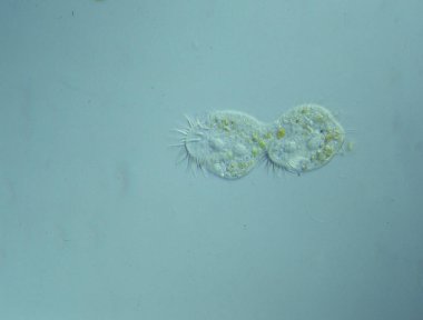 Mikroskop altında büyütüldüğünde su damlacıklarındaki ciliat 100x