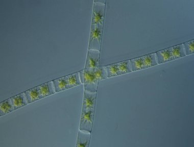 Yeşil yosunlar mikroskop altında büyüteç altında